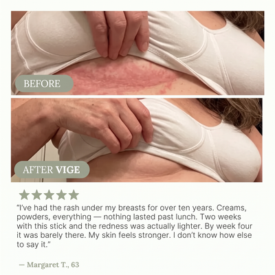 VIGE™ Anti-Friction Stick