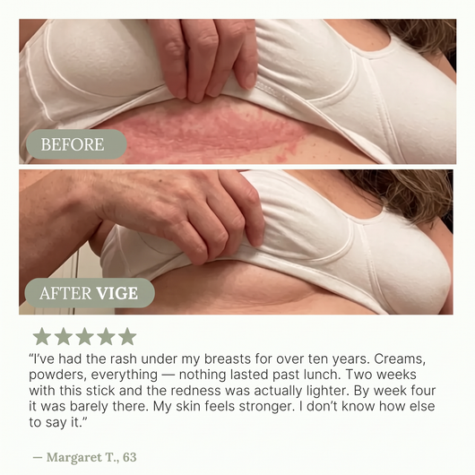 VIGE™ Anti-Friction Stick