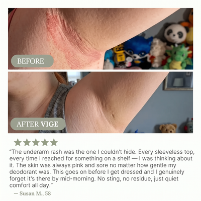 VIGE™ Anti-Friction Stick
