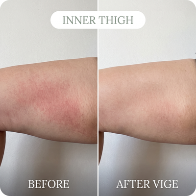 VIGE™ Anti-Friction Stick