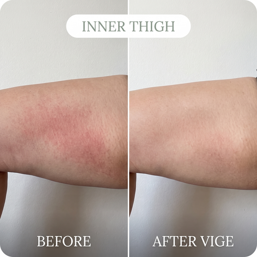 VIGE™ Anti-Friction Stick