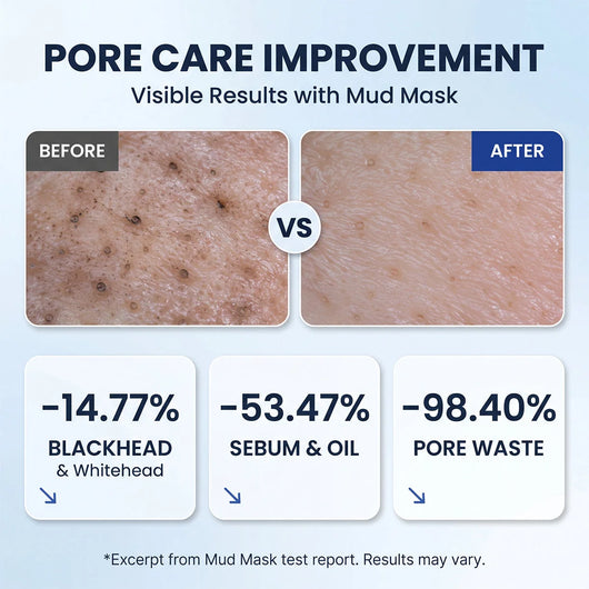 Zero Pores Blackhead Mud Mask