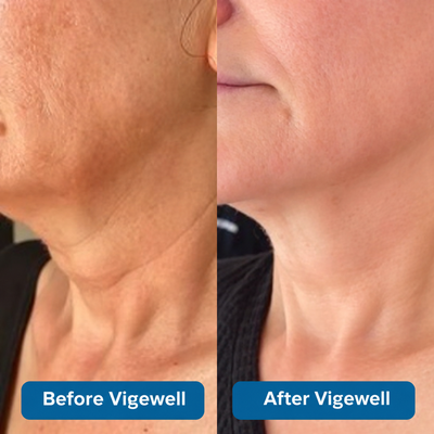 3% Hyaluronic Acid Ultra Hydrating Serum