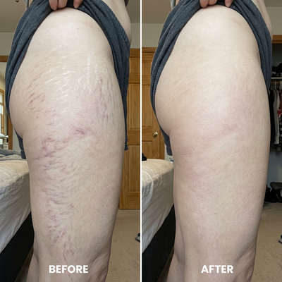 Cryo Thermo Firming Gold Gel