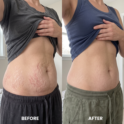 Cryo Thermo Firming Gold Gel