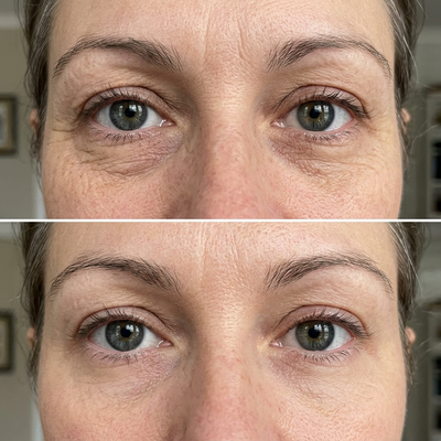 P7 Eye Renewal Crème